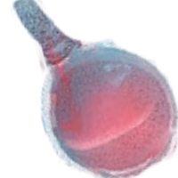 Potion